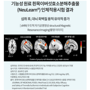 믿고주문 요즘 대세인 ​뉴트리원 인지 기능엔 뉴런600 완벽한 스팩은 어디까지일까요? 상세히 리뷰 해보겠습니다. HOT