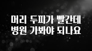 대박소식 머리 두피가 빨간데 병원 가봐야 되나요 소개합니다
