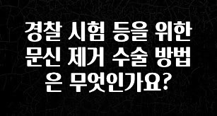 인스타 정보 경찰 시험 등을 위한 문신 제거 수술 방법은 무엇인가요? 알려드릴게요